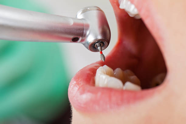 Best Emergency Cosmetic Dentistry (e.g., broken veneers) in Lima, OH